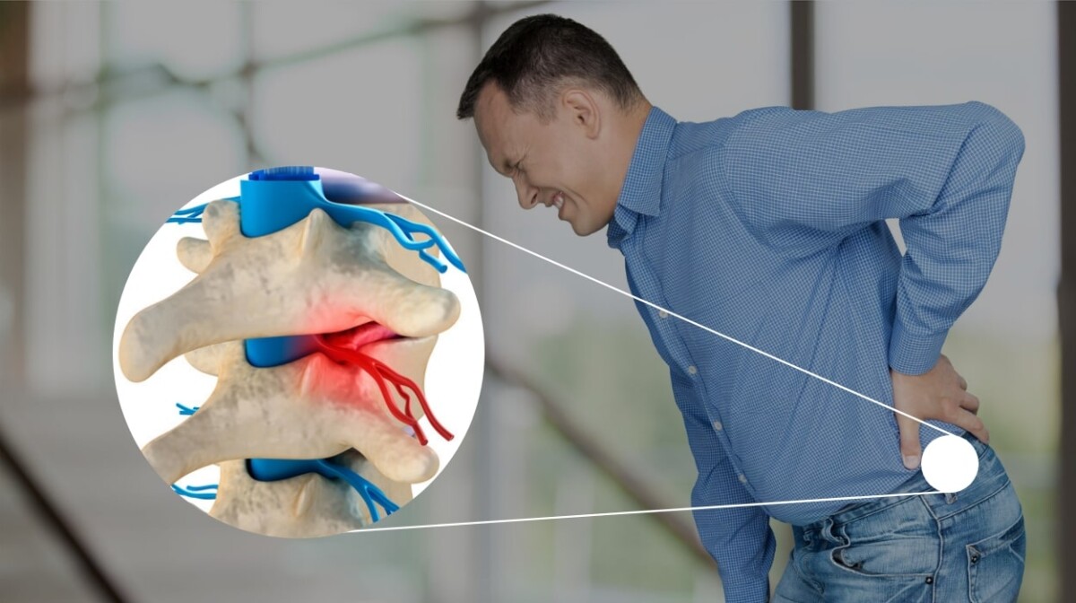 Chiropractor for Sciatica (nerve pain) Chiropractor for Sciatica (nerve pain)